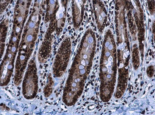 HMGA2 Antibody in Immunohistochemistry (Paraffin) (IHC (P))