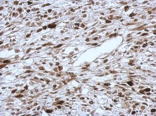 HMGA2 Antibody in Immunohistochemistry (Paraffin) (IHC (P))