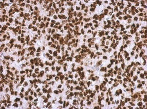 HMGA2 Antibody in Immunohistochemistry (Paraffin) (IHC (P))