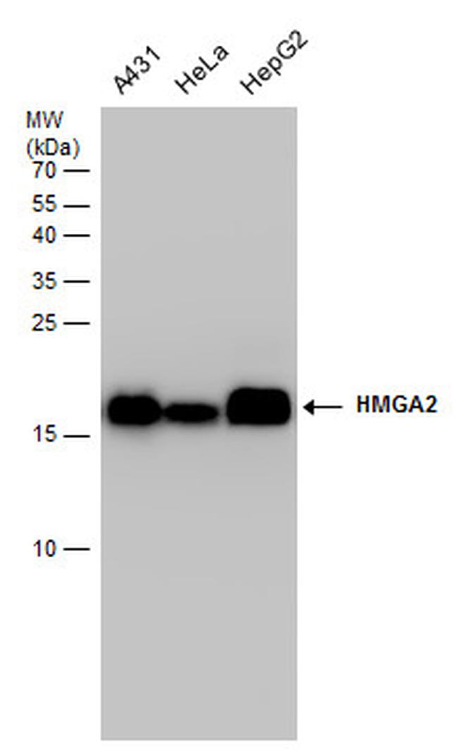 HMGA2 Antibody in Western Blot (WB)