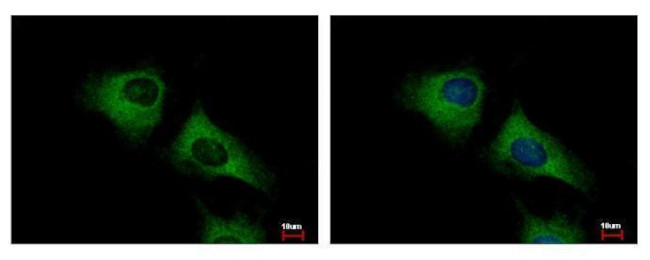 SCARA3 Antibody in Immunocytochemistry (ICC/IF)