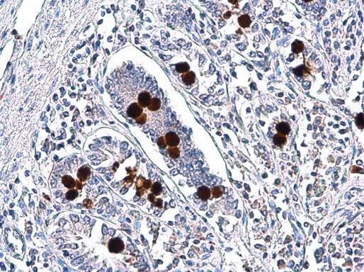 MUC2 Antibody in Immunohistochemistry (Paraffin) (IHC (P))