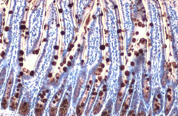 MUC2 Antibody in Immunohistochemistry (Paraffin) (IHC (P))