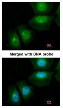 S100A11 Antibody in Immunocytochemistry (ICC/IF)