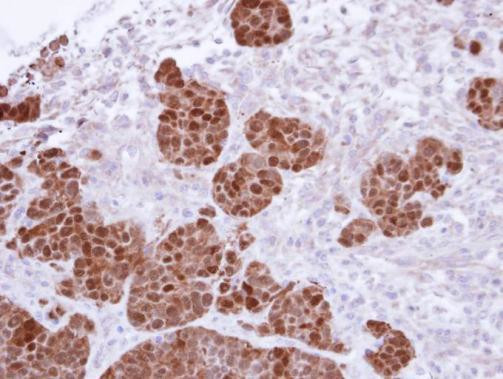 S100A11 Antibody in Immunohistochemistry (Paraffin) (IHC (P))