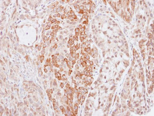 Kininogen 1 Antibody in Immunohistochemistry (Paraffin) (IHC (P))