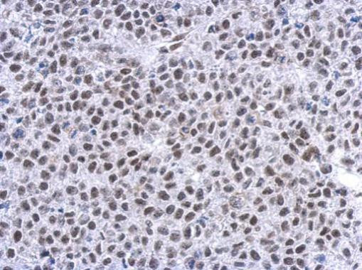 Glucocorticoid Receptor Antibody in Immunohistochemistry (Paraffin) (IHC (P))