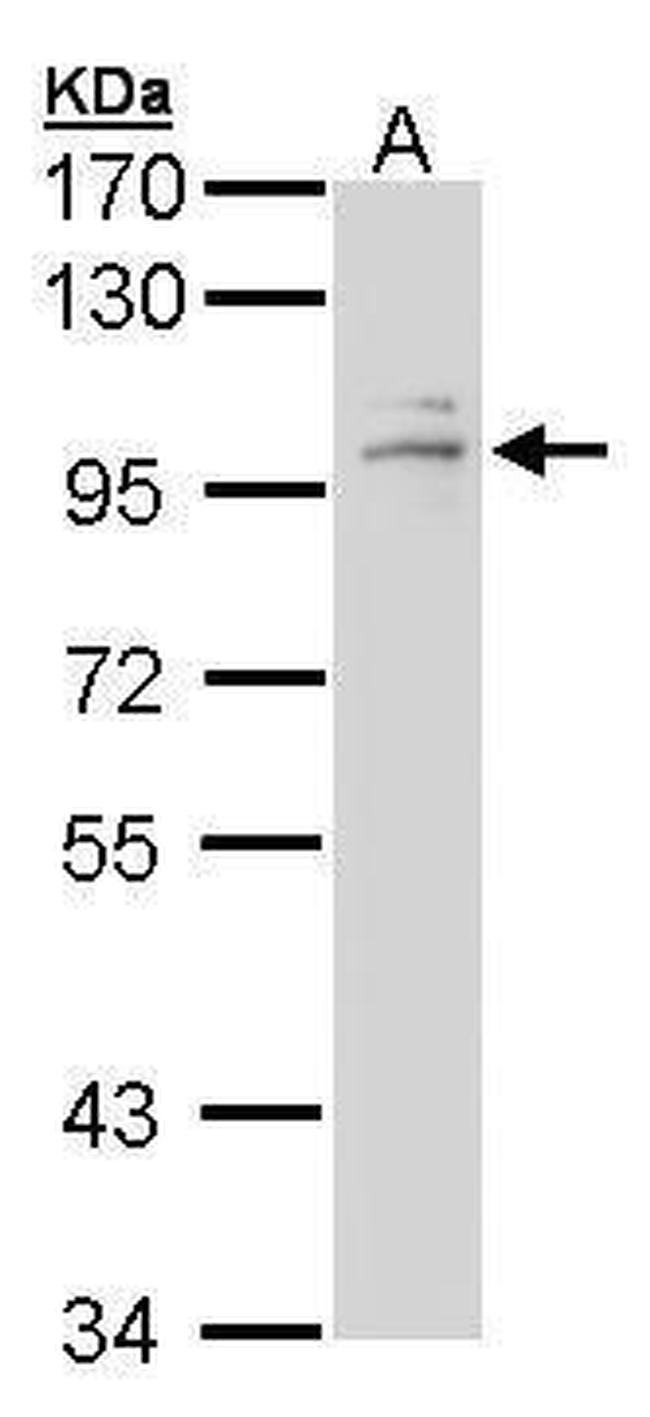 Glucocorticoid Receptor Antibody in Western Blot (WB)