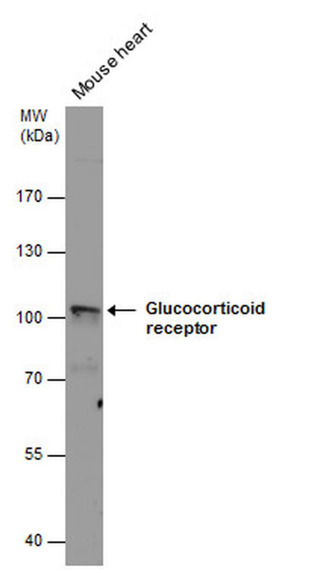 Glucocorticoid Receptor Antibody in Western Blot (WB)