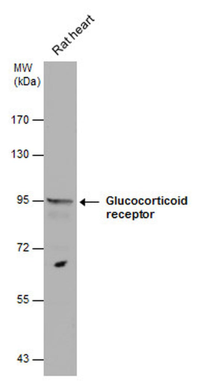 Glucocorticoid Receptor Antibody in Western Blot (WB)