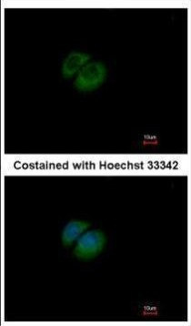 HPRT1 Antibody in Immunocytochemistry (ICC/IF)