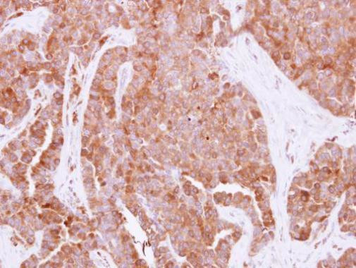 HPRT1 Antibody in Immunohistochemistry (Paraffin) (IHC (P))