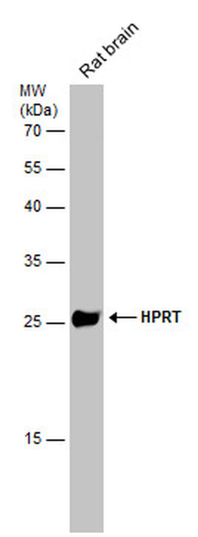 HPRT1 Antibody in Western Blot (WB)