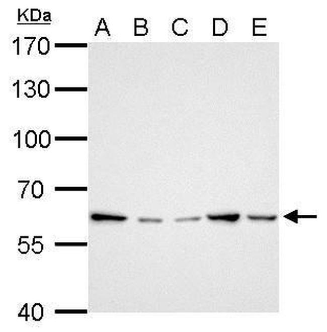 GGT1 Antibody in Western Blot (WB)