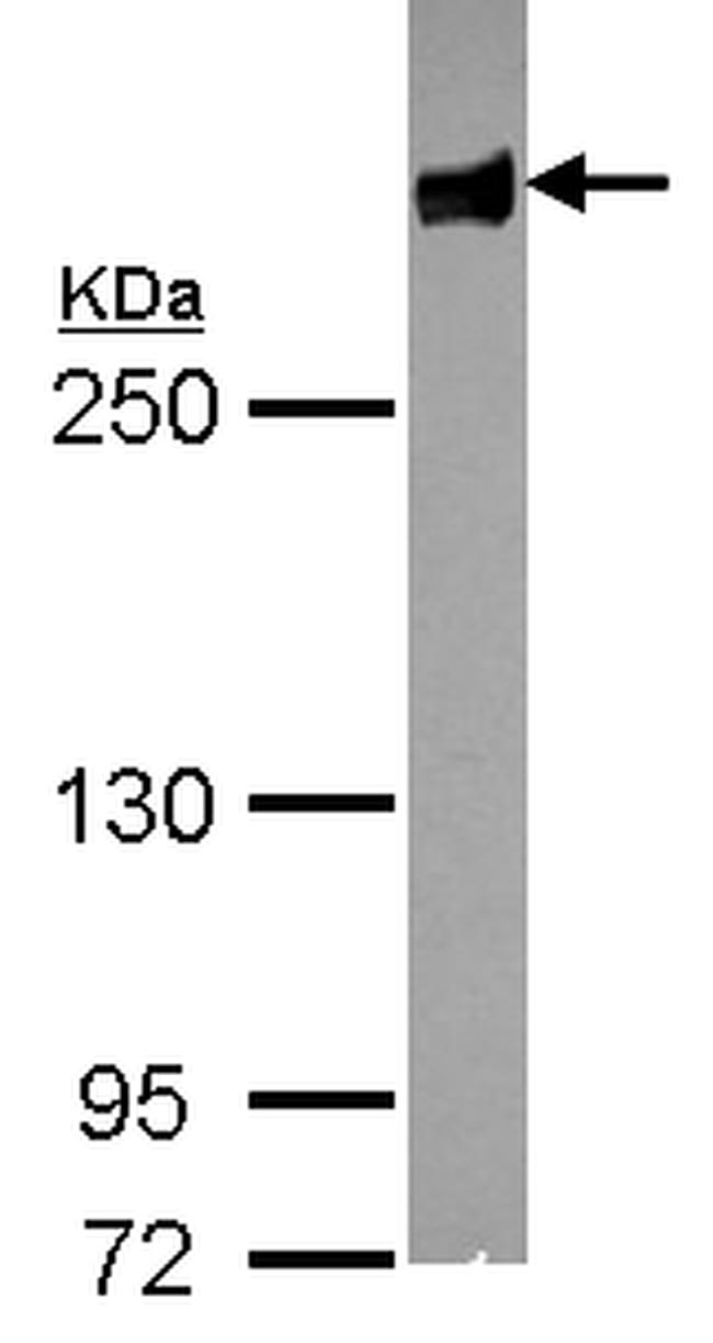 Filamin B Antibody in Western Blot (WB)