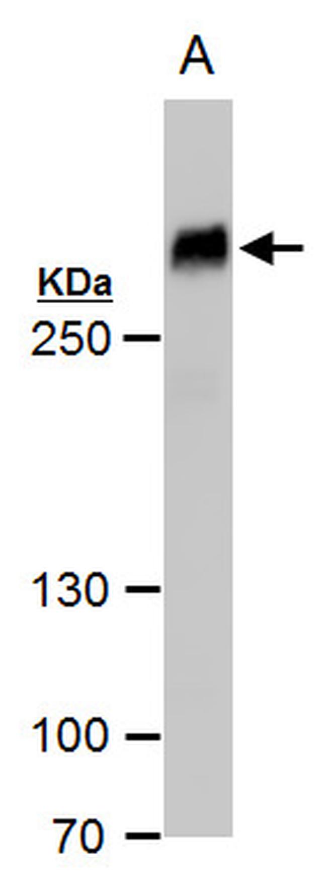 Filamin B Antibody in Western Blot (WB)