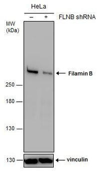 Filamin B Antibody