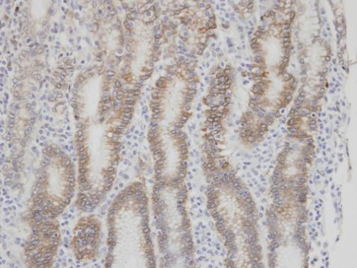 Factor VII Antibody in Immunohistochemistry (Paraffin) (IHC (P))