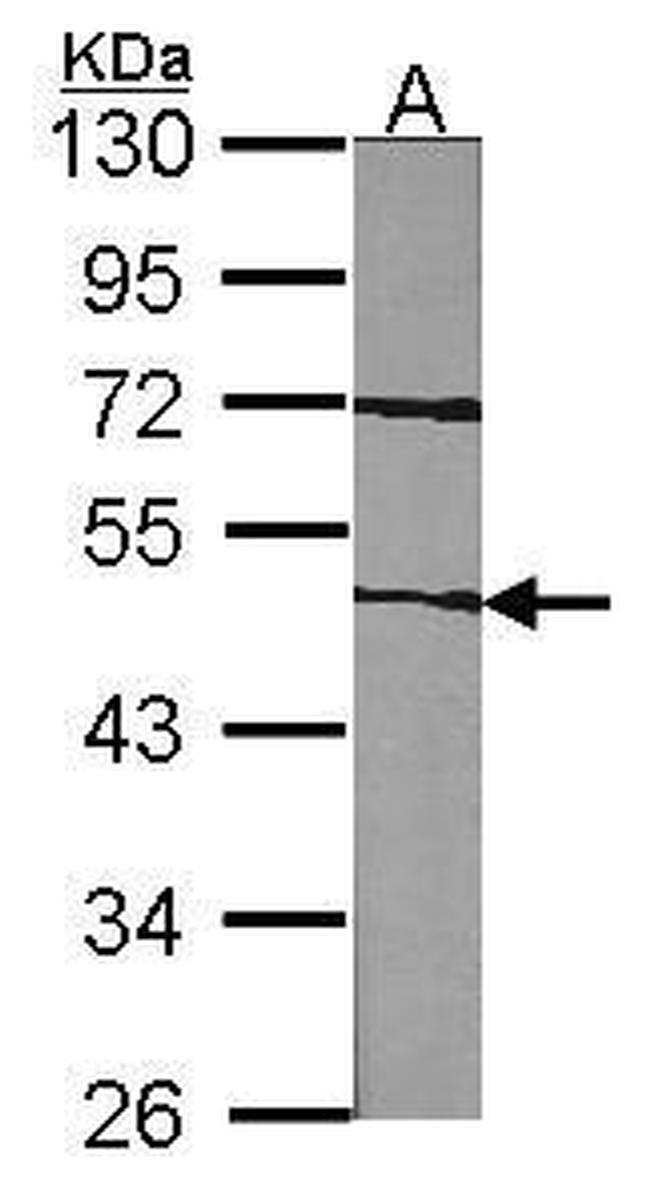 Factor VII Antibody in Western Blot (WB)