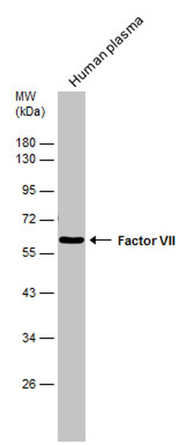 Factor VII Antibody in Western Blot (WB)