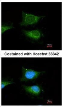 GBA Antibody in Immunocytochemistry (ICC/IF)