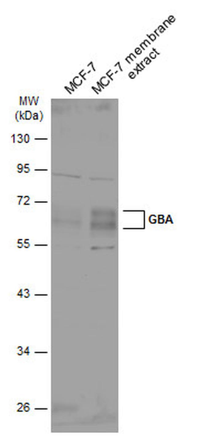 GBA Antibody in Western Blot (WB)