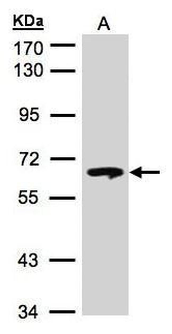 GBA Antibody in Western Blot (WB)