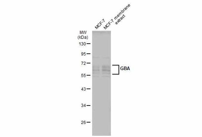 GBA Antibody in Western Blot (WB)