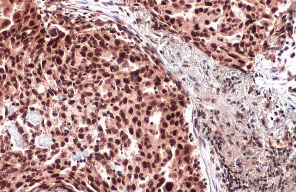 ATRX Antibody in Immunohistochemistry (Paraffin) (IHC (P))