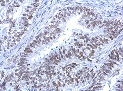 ATRX Antibody in Immunohistochemistry (Paraffin) (IHC (P))