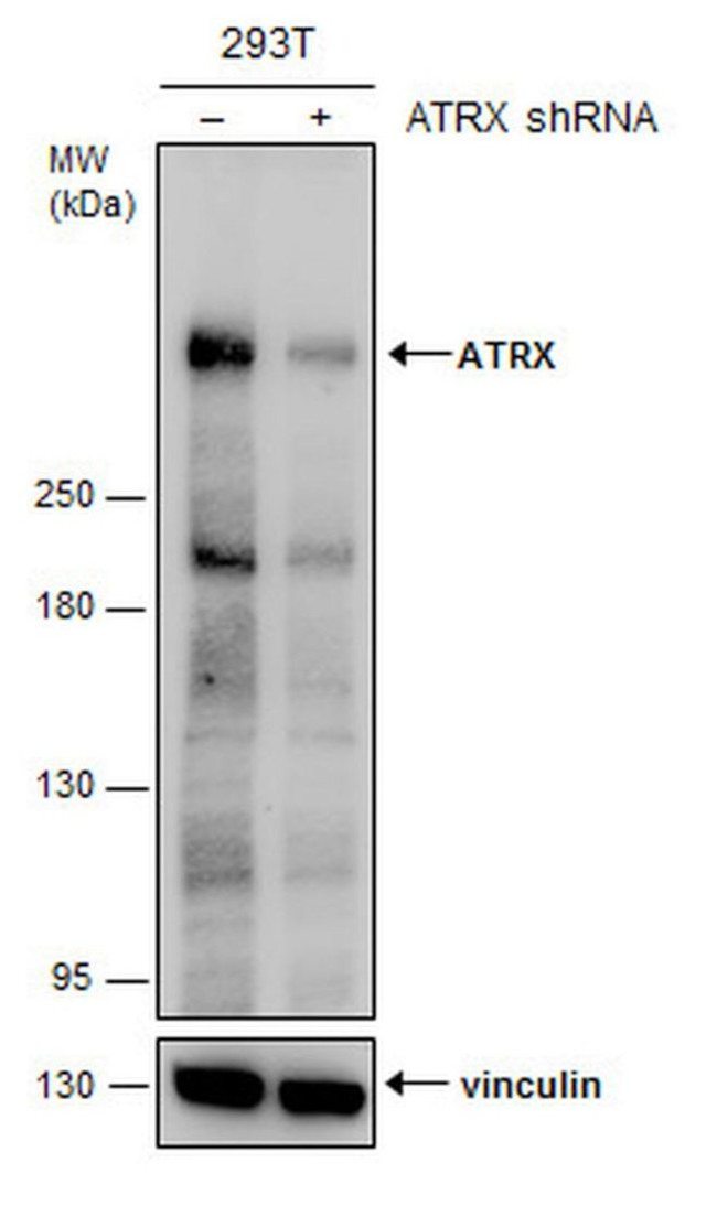 ATRX Antibody