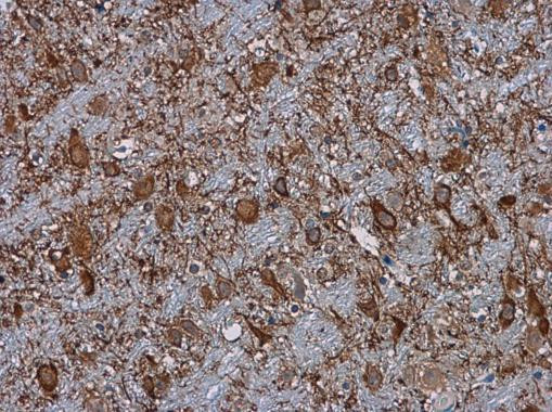 Complement C3 Antibody in Immunohistochemistry (Paraffin) (IHC (P))