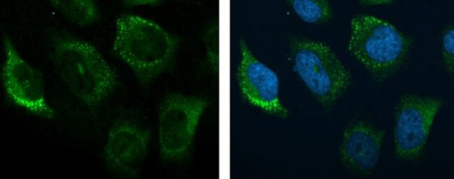 Complement C3 Antibody in Immunocytochemistry (ICC/IF)