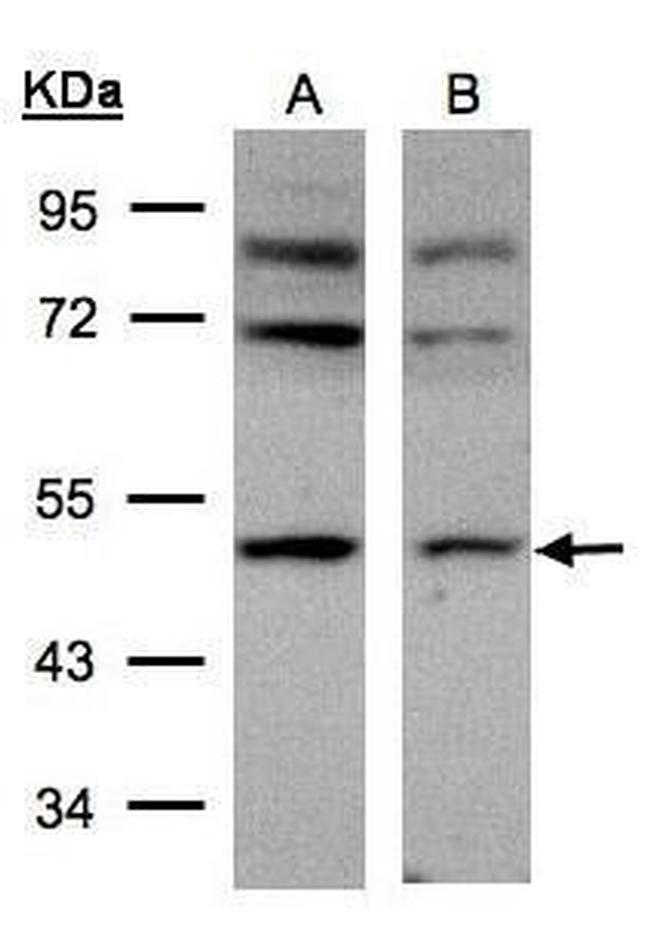 AP2M1 Antibody in Western Blot (WB)