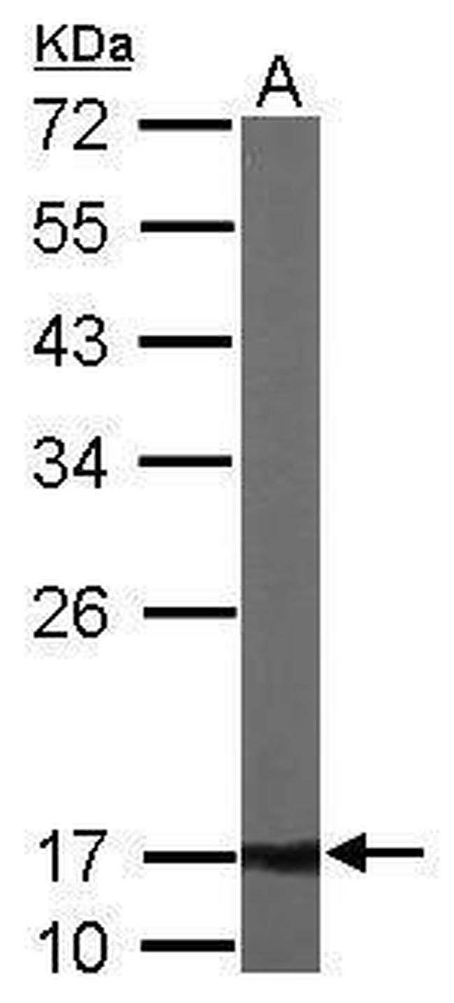 ATP5D Antibody in Western Blot (WB)