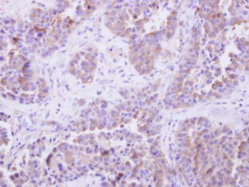 SGTA Antibody in Immunohistochemistry (Paraffin) (IHC (P))