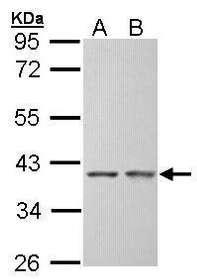 SGTA Antibody in Western Blot (WB)