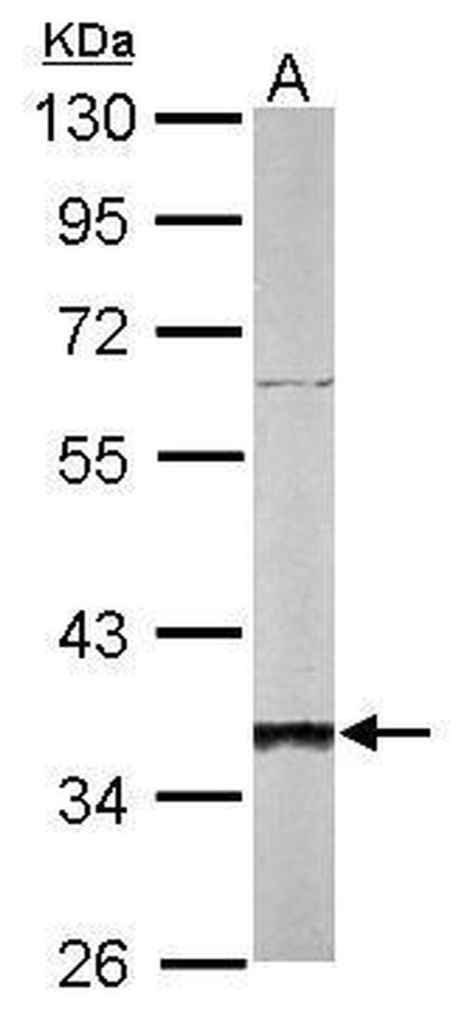 SGTA Antibody in Western Blot (WB)