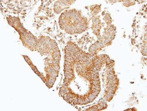 Septin-7 Antibody in Immunohistochemistry (Paraffin) (IHC (P))