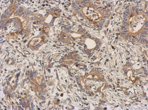 LEFTY2 Antibody in Immunohistochemistry (Paraffin) (IHC (P))