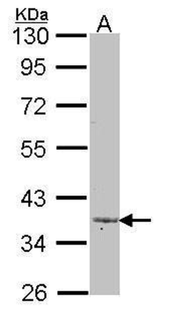 LEFTY2 Antibody in Western Blot (WB)