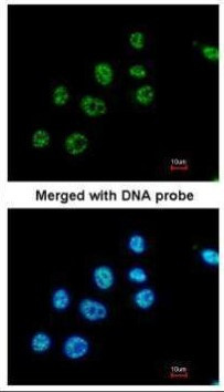 PAX8 Antibody in Immunocytochemistry (ICC/IF)