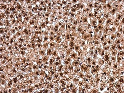 PAX8 Antibody in Immunohistochemistry (Paraffin) (IHC (P))