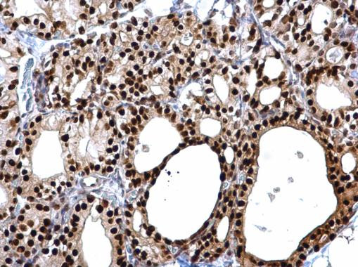 PAX8 Antibody in Immunohistochemistry (Paraffin) (IHC (P))