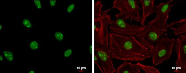 ADAR1 Antibody in Immunocytochemistry (ICC/IF)