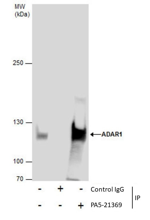 ADAR1 Antibody in Immunoprecipitation (IP)