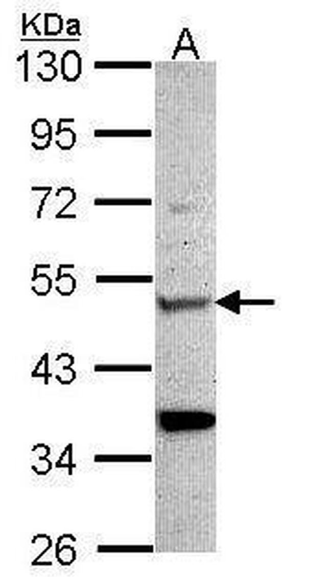 Chitotriosidase Antibody in Western Blot (WB)