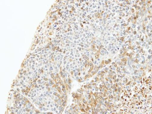 CAPZB Antibody in Immunohistochemistry (Paraffin) (IHC (P))