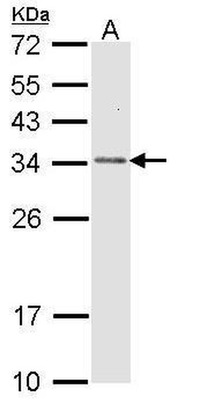 CAPZB Antibody in Western Blot (WB)