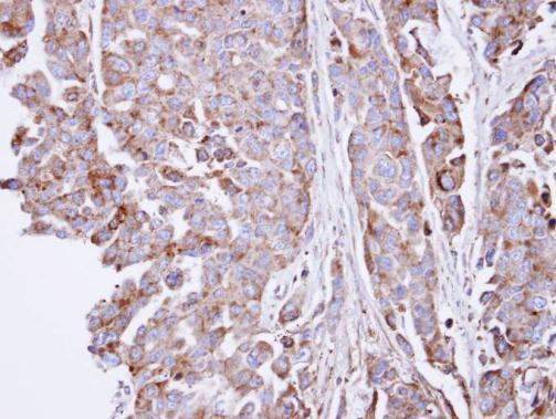 SGSH Antibody in Immunohistochemistry (Paraffin) (IHC (P))